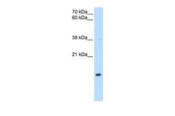NDUFB5 Rabbit Polyclonal Antibody