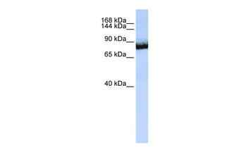 UNC5C Rabbit Polyclonal Antibody
