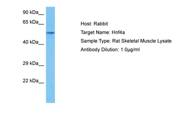 HNF4A Rabbit Polyclonal Antibody