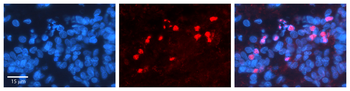 RORA Rabbit Polyclonal Antibody