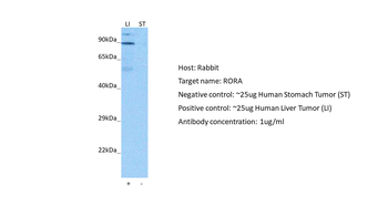 RORA Rabbit Polyclonal Antibody
