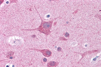 RORC Rabbit Polyclonal Antibody