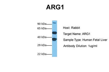 ARG1 Rabbit Polyclonal Antibody