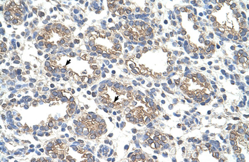 ARG1 Rabbit Polyclonal Antibody