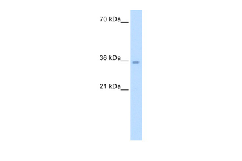ATIC Rabbit Polyclonal Antibody