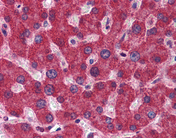MTHFD1 Rabbit Polyclonal Antibody