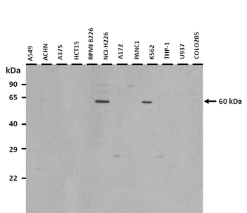 ERVW-1 Rabbit Polyclonal Antibody