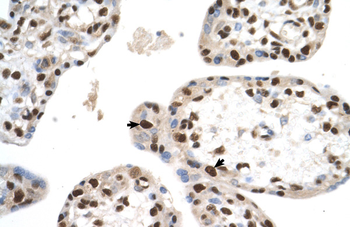 SETD2 Rabbit Polyclonal Antibody