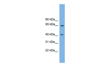 PLEKHO1 Rabbit Polyclonal Antibody