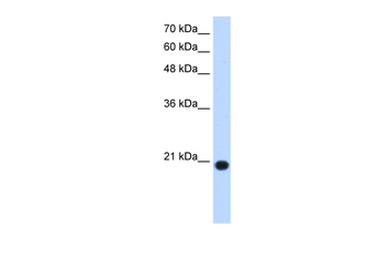 UXT Rabbit Polyclonal Antibody