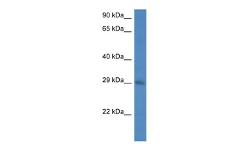 Sdhb Rabbit Polyclonal Antibody