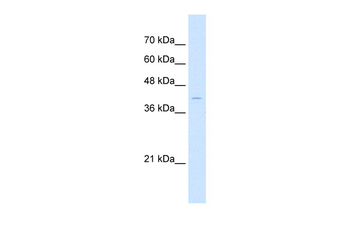 ARRB2 Rabbit Polyclonal Antibody