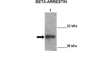 ARRB2 Rabbit Polyclonal Antibody