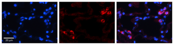 IGFBP7 Rabbit Polyclonal Antibody