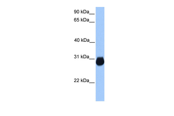 IGFBP7 Rabbit Polyclonal Antibody