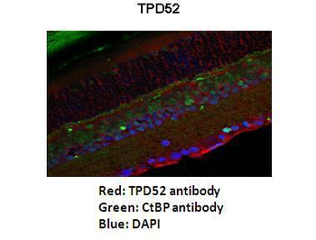TPD52 Rabbit Polyclonal Antibody