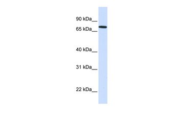 SETDB2 Rabbit Polyclonal Antibody