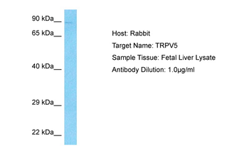 TRPV5 Rabbit Polyclonal Antibody