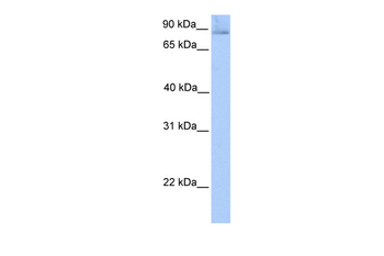 SLITRK1 Rabbit Polyclonal Antibody
