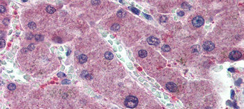 HYAL1 Rabbit Polyclonal Antibody
