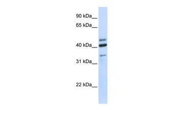 HYAL1 Rabbit Polyclonal Antibody