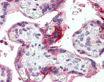 GPSM2 Rabbit Polyclonal Antibody