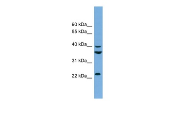 SAE1 Rabbit Polyclonal Antibody
