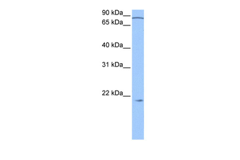 ARPC3 Rabbit Polyclonal Antibody
