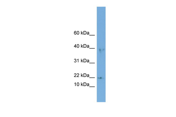 ARPC3 Rabbit Polyclonal Antibody