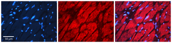 HAX1 Rabbit Polyclonal Antibody