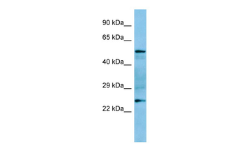 Grap Rabbit Polyclonal Antibody