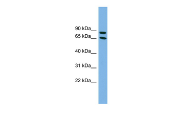 DAB1 Rabbit Polyclonal Antibody