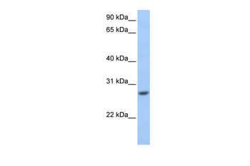 GSTM3 Rabbit Polyclonal Antibody