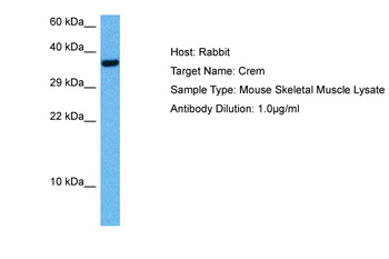 CREM Rabbit Polyclonal Antibody
