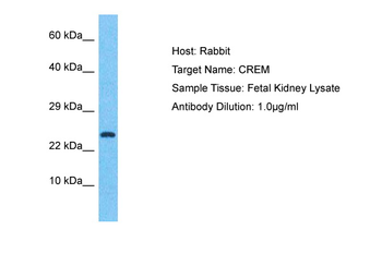 CREM Rabbit Polyclonal Antibody