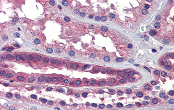 SSX2IP Rabbit Polyclonal Antibody
