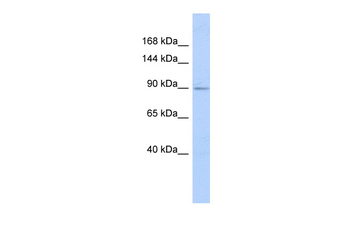 HSPA4L Rabbit Polyclonal Antibody