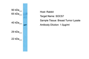 SOCS7 Rabbit Polyclonal Antibody