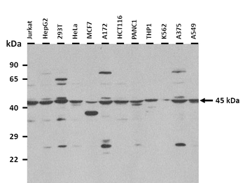 APOA4 Rabbit Polyclonal Antibody