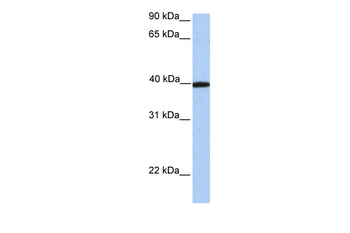 APOA4 Rabbit Polyclonal Antibody