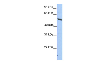 IMPDH2 Rabbit Polyclonal Antibody