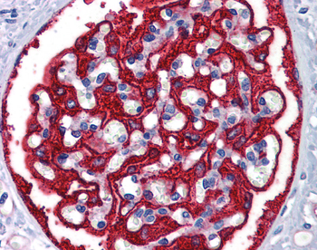 FTH1 Rabbit Polyclonal Antibody