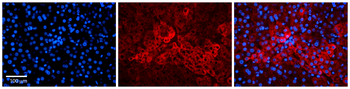 GRN Rabbit Polyclonal Antibody