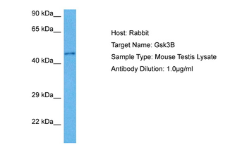 GSK3B Rabbit Polyclonal Antibody