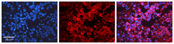 GSK3B Rabbit Polyclonal Antibody