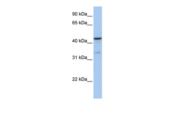 GSK3B Rabbit Polyclonal Antibody