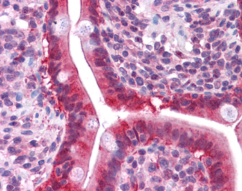 LGALS3 Rabbit Polyclonal Antibody