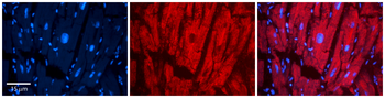 LASP1 Rabbit Polyclonal Antibody