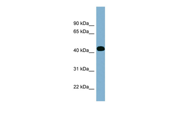 ITPK1 Rabbit Polyclonal Antibody