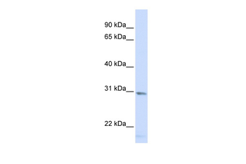 SMUG1 Rabbit Polyclonal Antibody